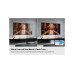 Samsung TV QE77S90H 77, 3840 x 2160 (Ultra HD 4K), OLED