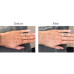 Rio LED-Handmaske handLITE