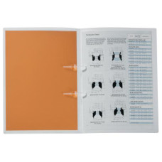 Kolma Schnellhefter Vario A4 KolmaFlex Transparent Kolma Schnellhefter Vario A4 KolmaFlex Transparent